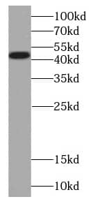 PCYT1B Antibody - BSA Free