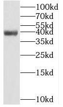 PCGF6 Antibody - BSA Free