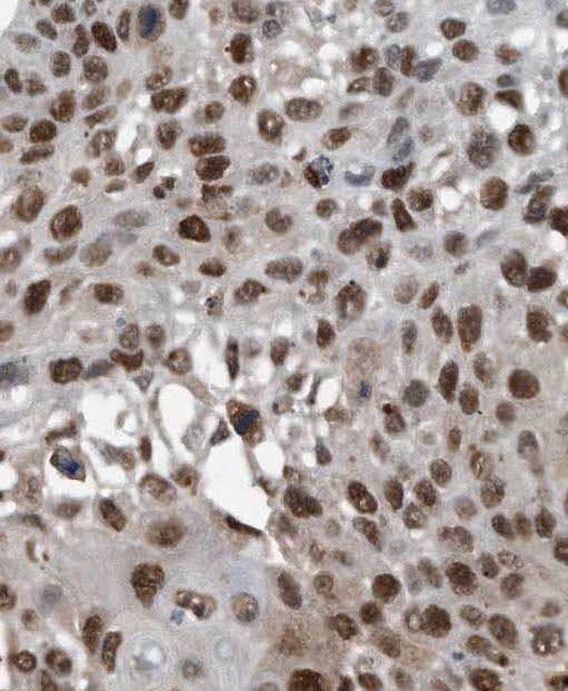 Pbx3 Antibody - BSA Free