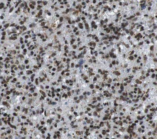 BAL/PARP9 Antibody - BSA Free