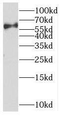 PARP6 Antibody - BSA Free