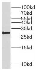 PARP11 Antibody - BSA Free