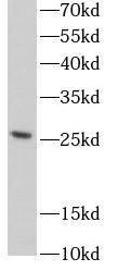 PAQR4 Antibody - BSA Free
