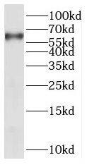 PANK1 Antibody - BSA Free
