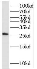 PAIP2 Antibody - BSA Free