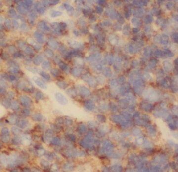 PAFAH2 Antibody - BSA Free