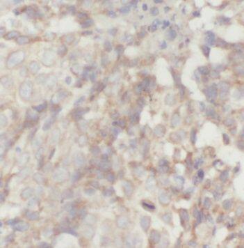 PACSIN2 Antibody - BSA Free