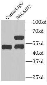 PACSIN2 Antibody - BSA Free