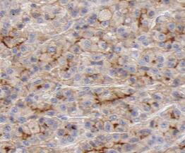 PACS2 Antibody - BSA Free