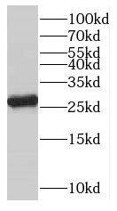 OVCA2 Antibody - BSA Free