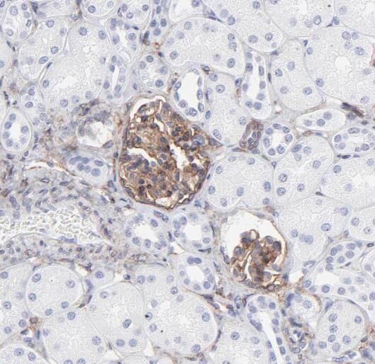 OVCA2 Antibody - BSA Free