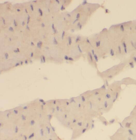 OVCA1 Antibody - BSA Free