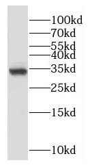 OTUD6A Antibody - BSA Free