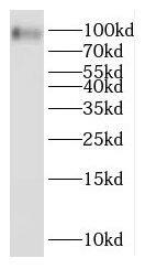 OTOP3 Antibody - BSA Free