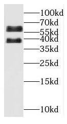 OSGIN1 Antibody - BSA Free