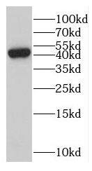 NOR1/OSCP1 Antibody - BSA Free