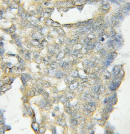 OSBPL11 Antibody - BSA Free