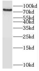 OSBPL10 Antibody - BSA Free