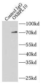 OSBPL10 Antibody - BSA Free