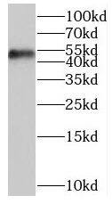 ORC5L Antibody - BSA Free