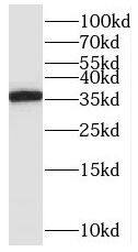 Orai2 Antibody - BSA Free