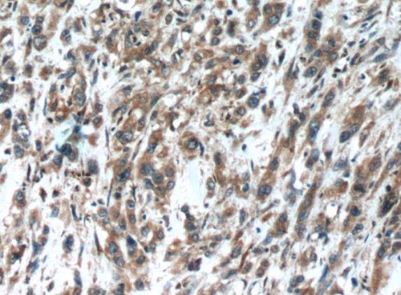 OPHN1 Antibody - BSA Free
