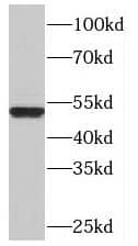 Optimedin Antibody - BSA Free