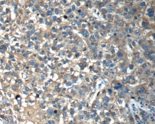 Optimedin Antibody - BSA Free