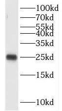 OIP5 Antibody - BSA Free