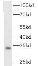 OGFOD2 Antibody - BSA Free