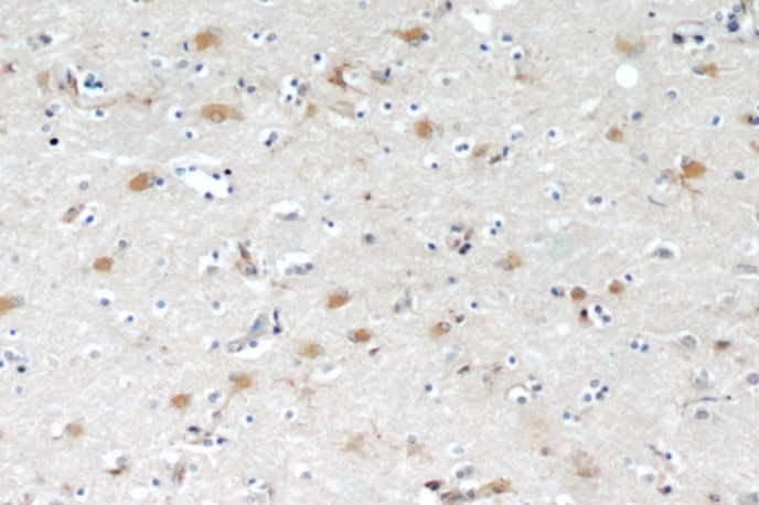 OGFOD2 Antibody - BSA Free