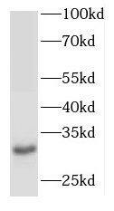 ODF3 Antibody - BSA Free