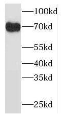 ODF2L Antibody - BSA Free