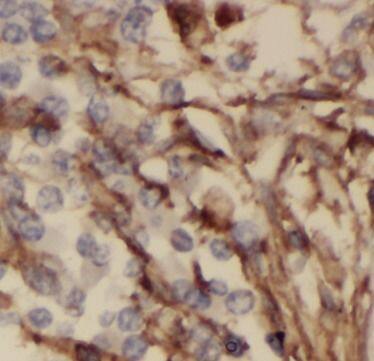 ODAM Antibody - BSA Free