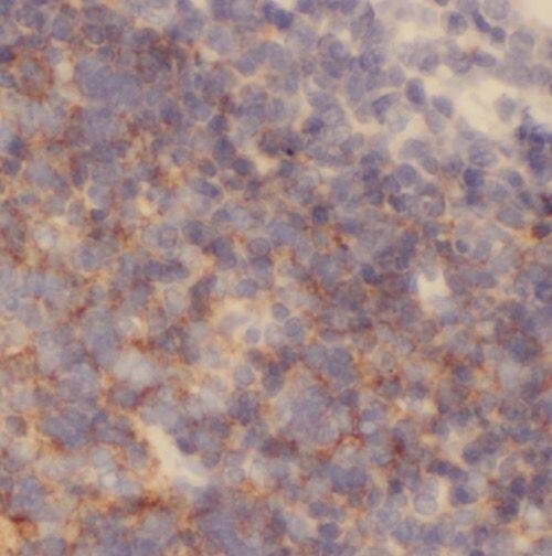 NXF2 Antibody - BSA Free