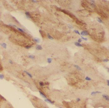 NUDT8 Antibody - BSA Free