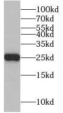 NUDT8 Antibody - BSA Free