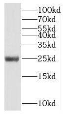 NUDT3 Antibody - BSA Free