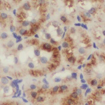 NUDT19 Antibody - BSA Free