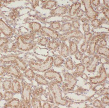NUDT16 Antibody - BSA Free
