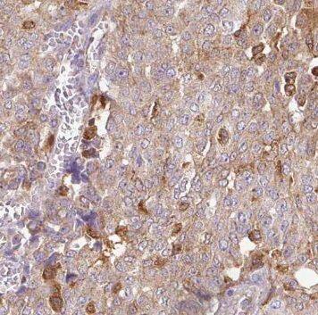 NUDT11 Antibody - BSA Free