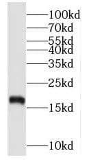NUDCD2 Antibody - BSA Free