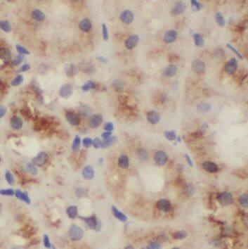 NUDCD2 Antibody - BSA Free