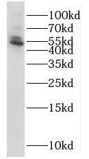 NT5DC1 Antibody - BSA Free