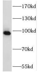NSUN2 Antibody - BSA Free