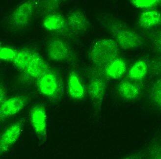 NSUN2 Antibody - BSA Free