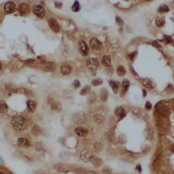 NSBP1 Antibody - BSA Free