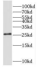 NRSN2 Antibody - BSA Free