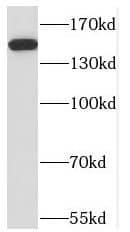 NPHP3 Antibody - BSA Free