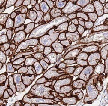 NPHP3 Antibody - BSA Free